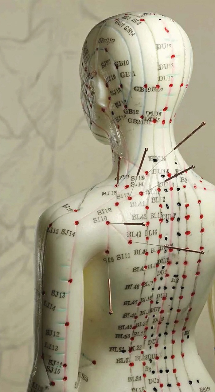 Comment fonctionne l'acupuncture