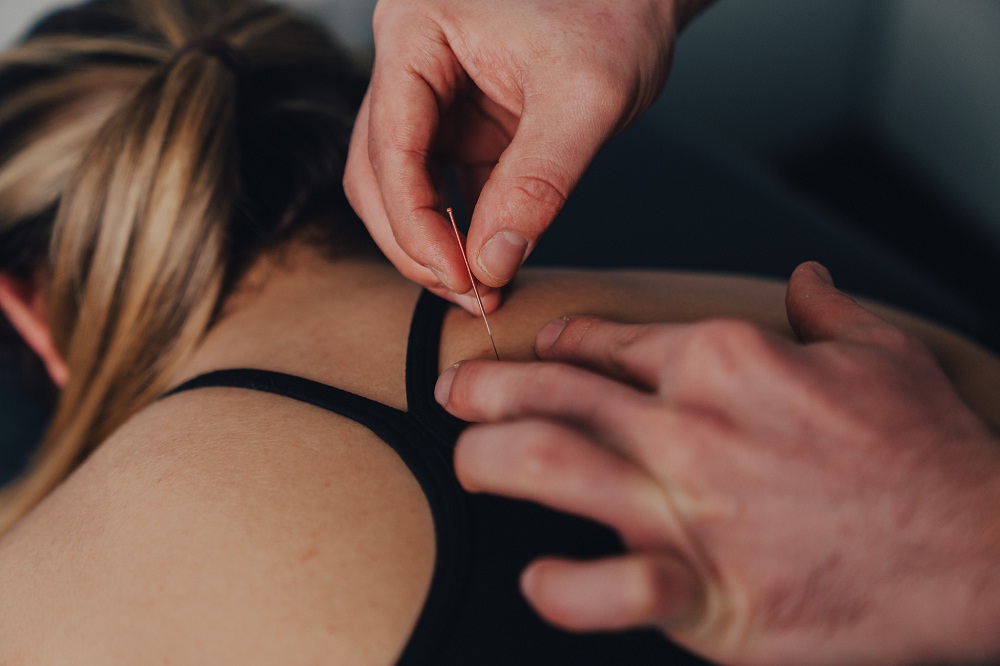 Trigger point acupuncture